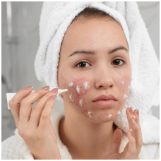 HOW TO PREVENT ADULT ACNE AND CONTROL OILY SKIN: 4 ESSENTIAL TIPS